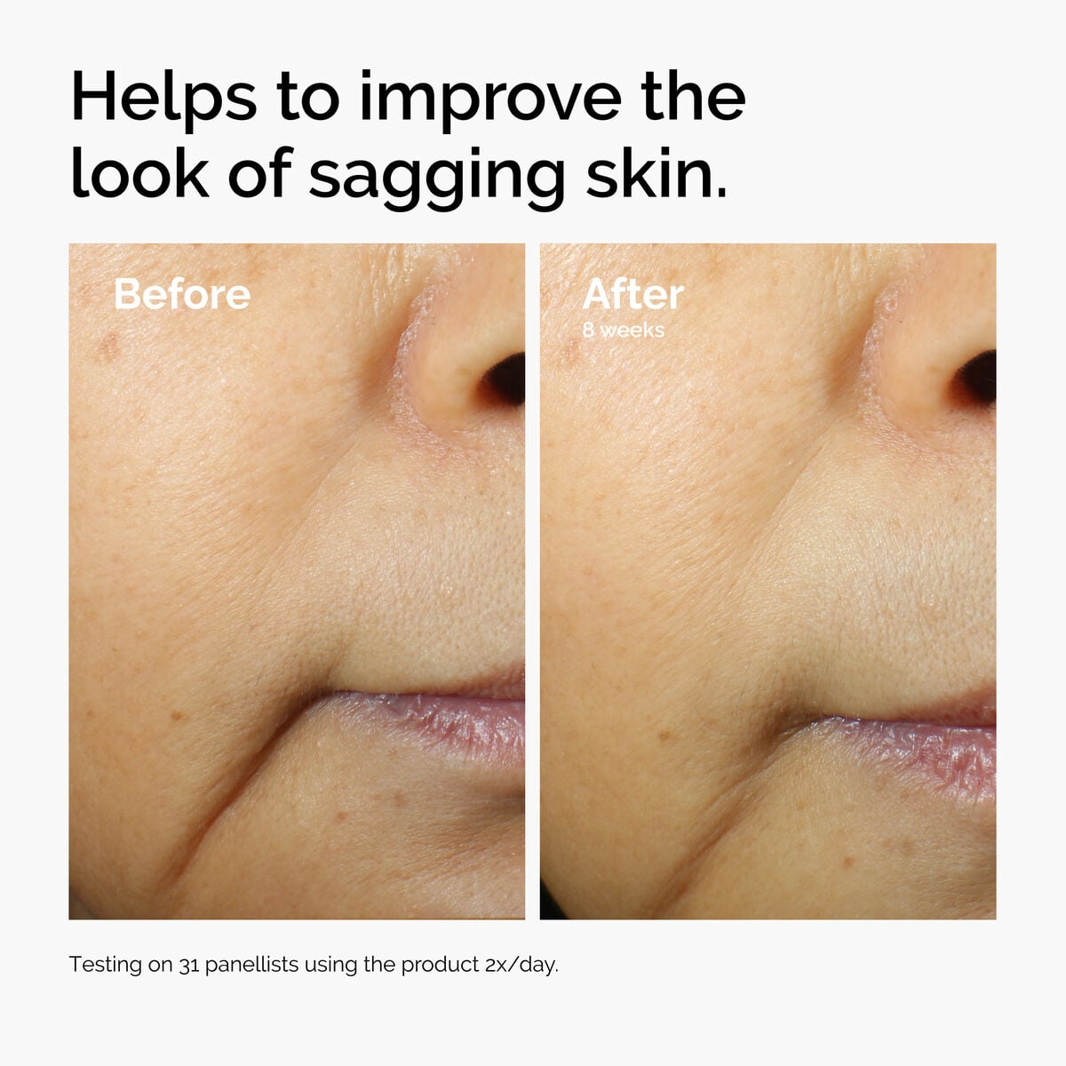 caffeine-3-escin-1-face-serum-x6 ord-caffeine-3pct-escin-1pct-face-serum-before-after-sagging.jpg