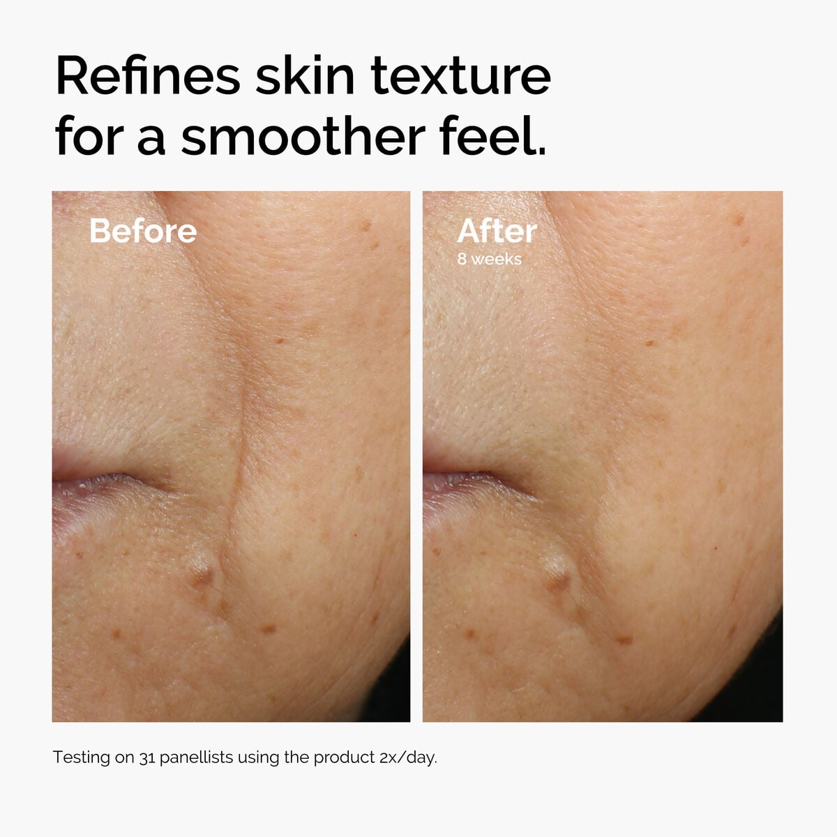 caffeine-3-escin-1-face-serum-x6 ord-caffeine-3pct-escin-1pct-face-serum-before-after-texture.jpg