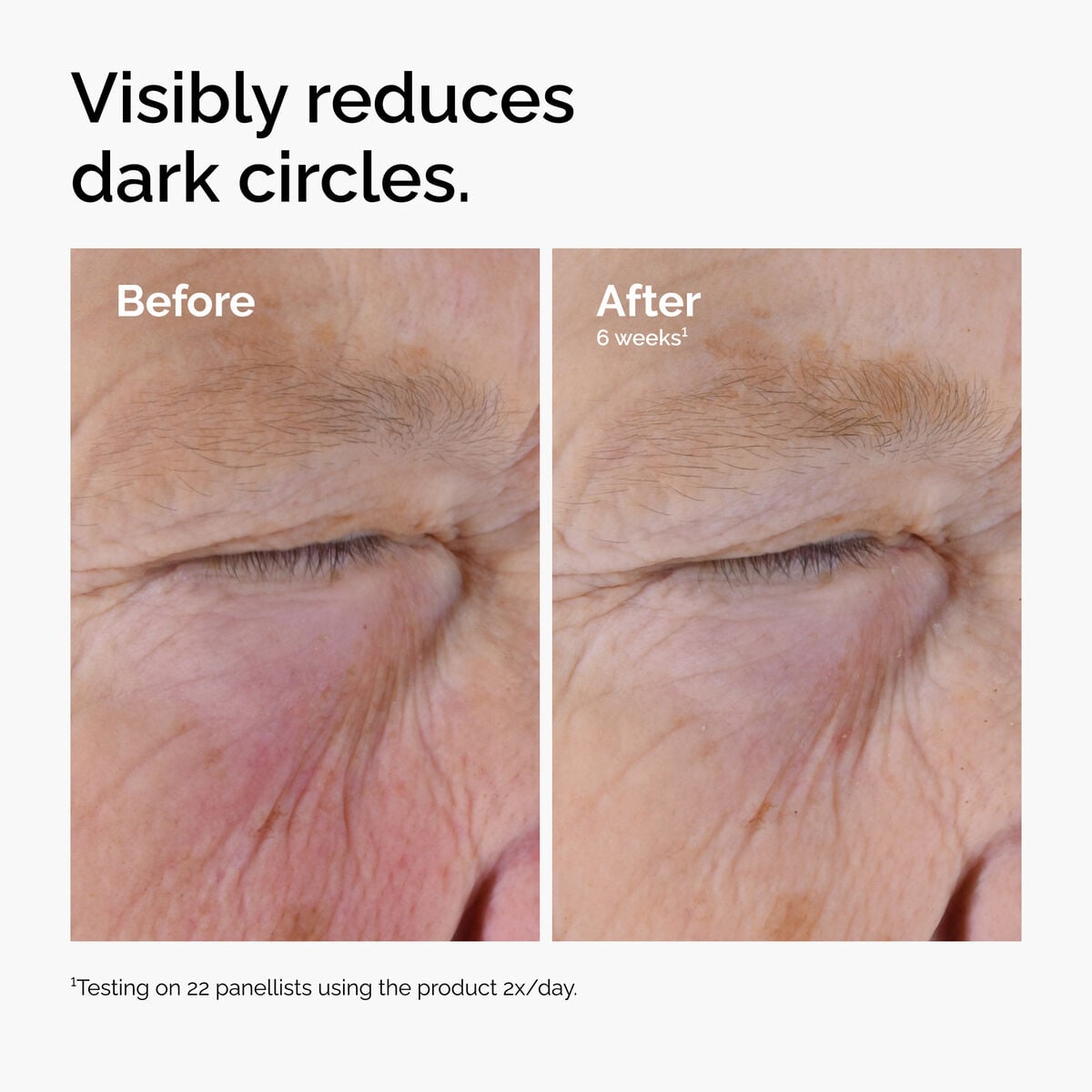 caffeine-solution-5-egcg-eye-serum-s3 ord-caffeine-solution-egcg-dark-circles-before-after.jpg