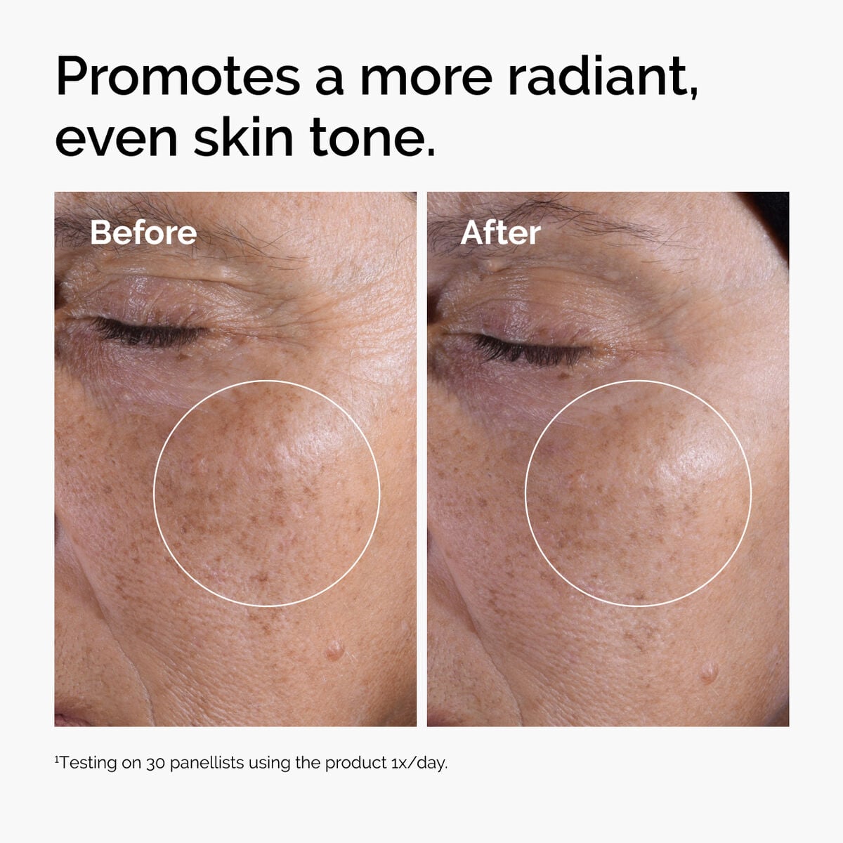 glycolic-acid-7-exfoliating-toner-i9 ord-glycolic-before-after-radiance.jpg