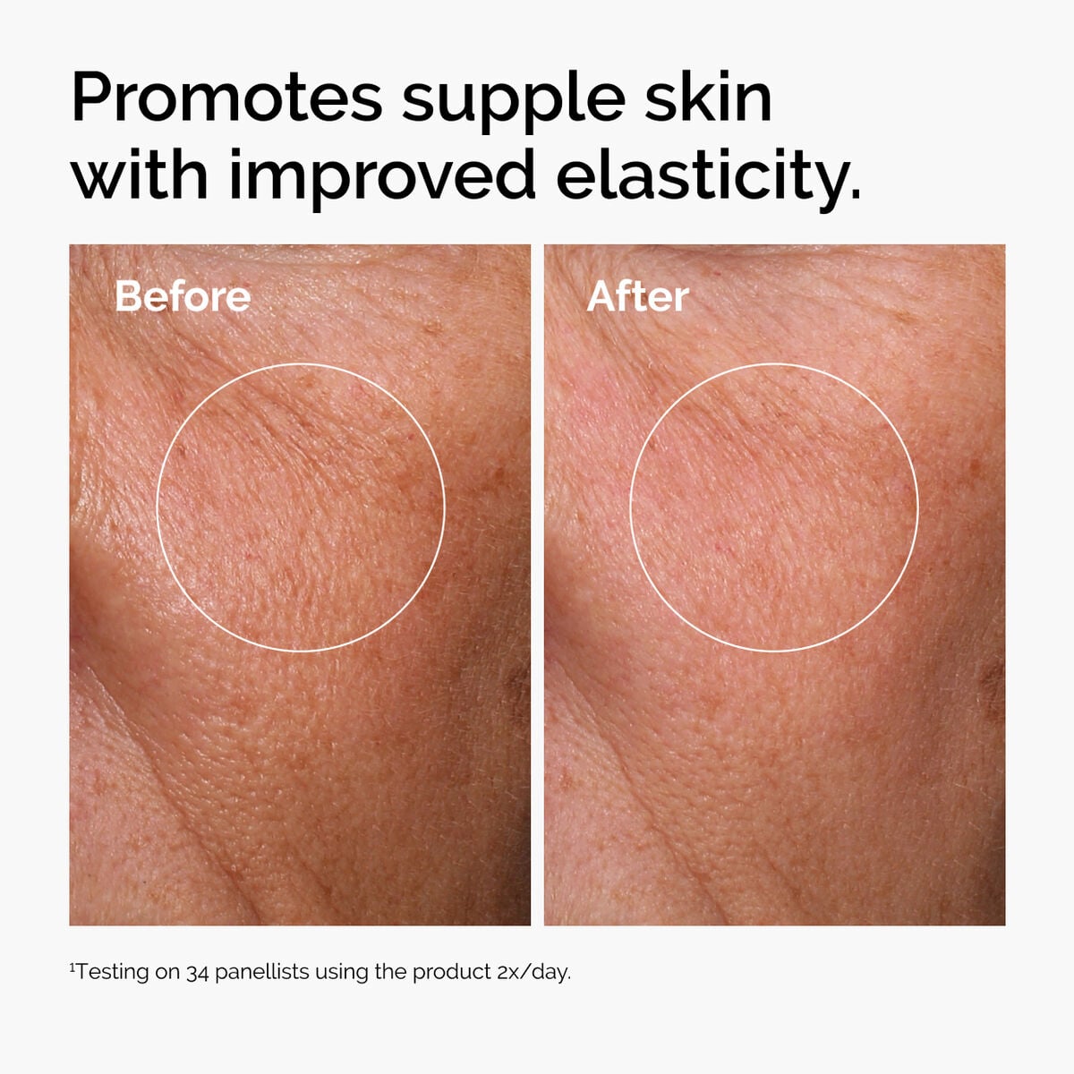 hyaluronic-acid-2-b5-with-ceramides-o3 ord-hyaluronic-acid-2pct-b5-hydrating-serum-before-after-elasticity.jpg