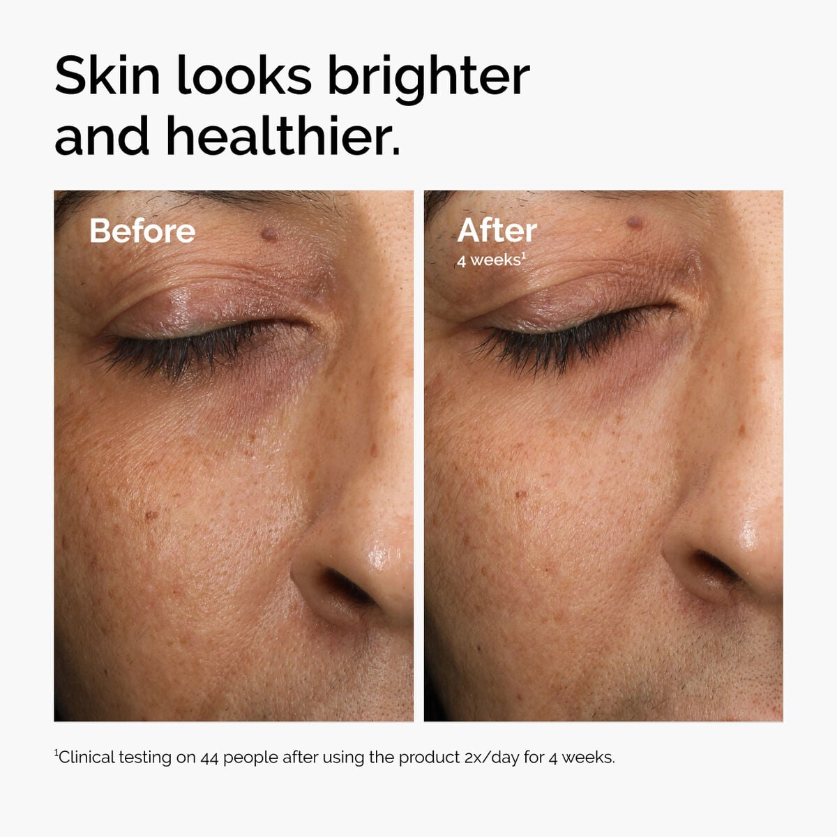 multi-antioxidant-radiance-serum-l6 ord-mars-before-after-healthy.jpg