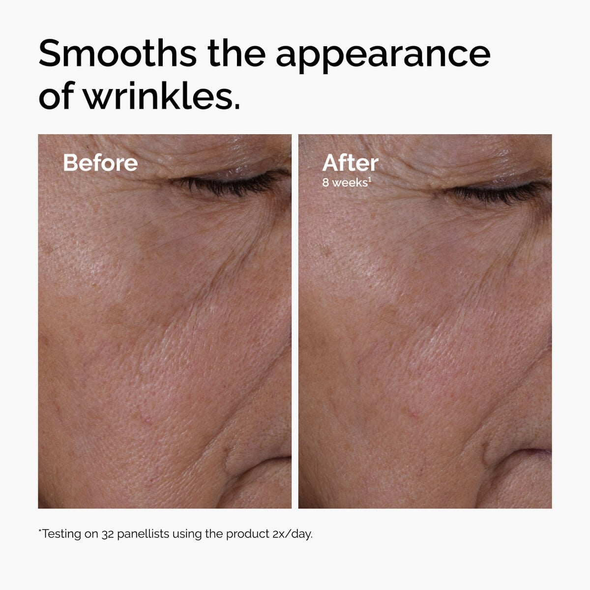 multi-peptide-ha-serum-n1 ord-multi-peptide-ha-serum-wrinkles-before-after.jpg