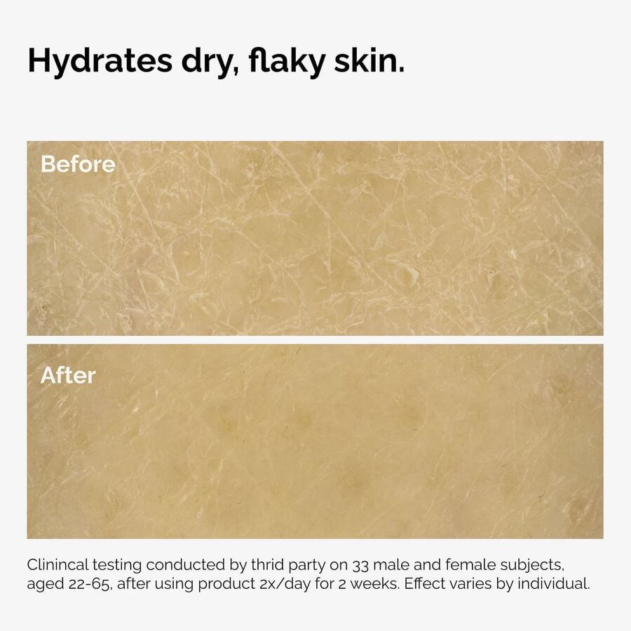 the-body-care-collection-d4 ord-natural-moisturizing-factors-inulin-body-before-after-graphic-02.jpg