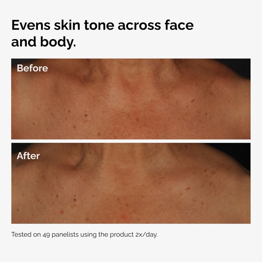 the-body-care-collection-d4 ord-niacinamide-face-body-serum-before-after-even-tone-graphic.jpg