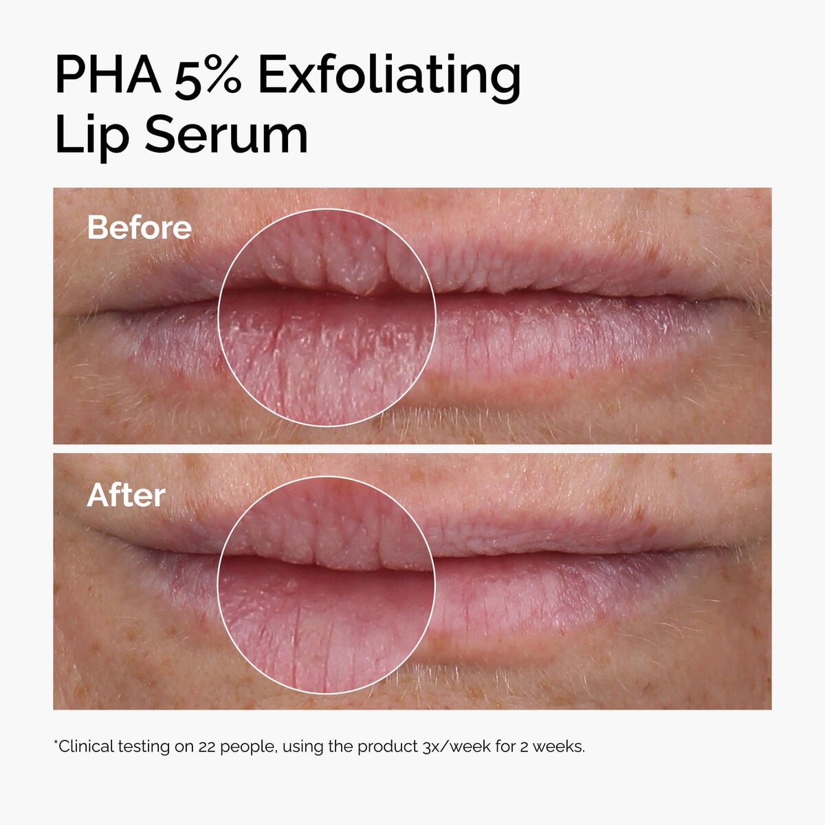 pha-5-exfoliating-lip-serum-i3 ord-pha-5pct-lip-exfoliating-serum-before-after.jpg